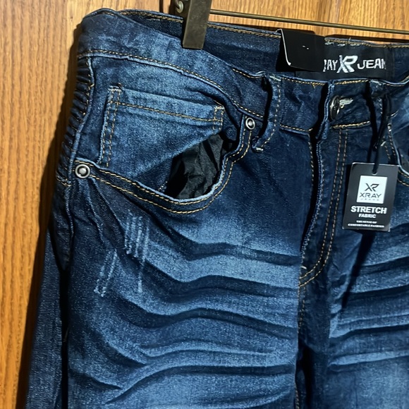 X-RAY - Picture 2 of 6